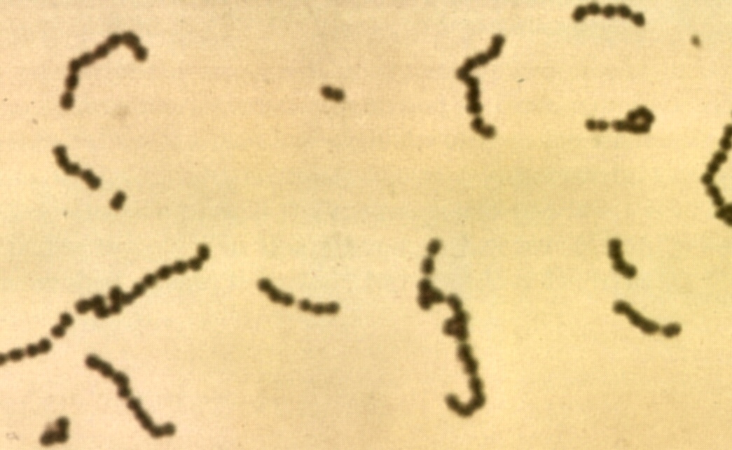 vi khuan gay benh xuat huyet ca ro phi  Streptococcus.jpg (185 KB)